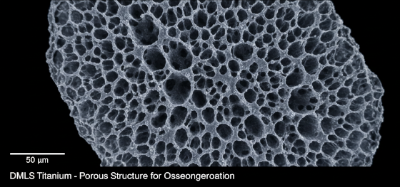 microscopic trabecular bone structure microscopic trabecular bone structure
